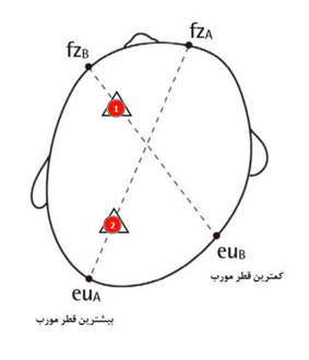 دیاگرام cranial_helmet - diagonal-diagram