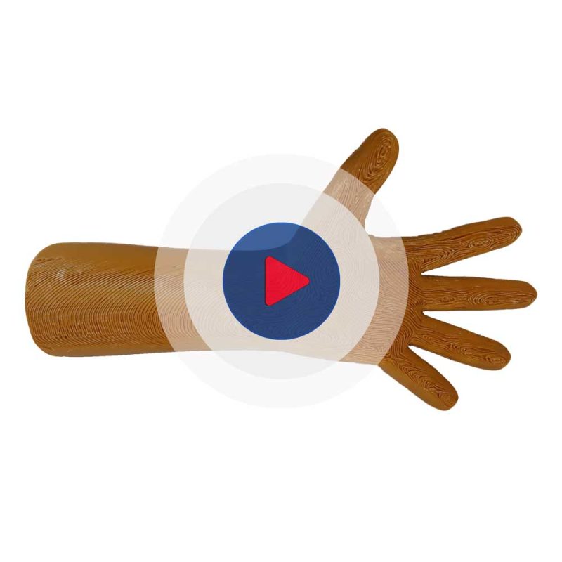 Pan-Splint
